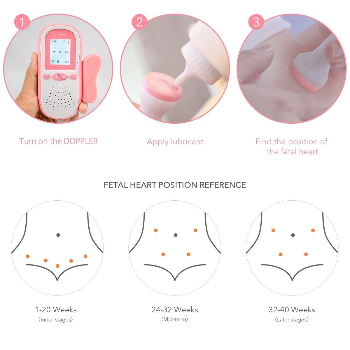 SpringBud FD 500B FDA Fetal Doppler Fedex 2 Day Shipping - SpringBud