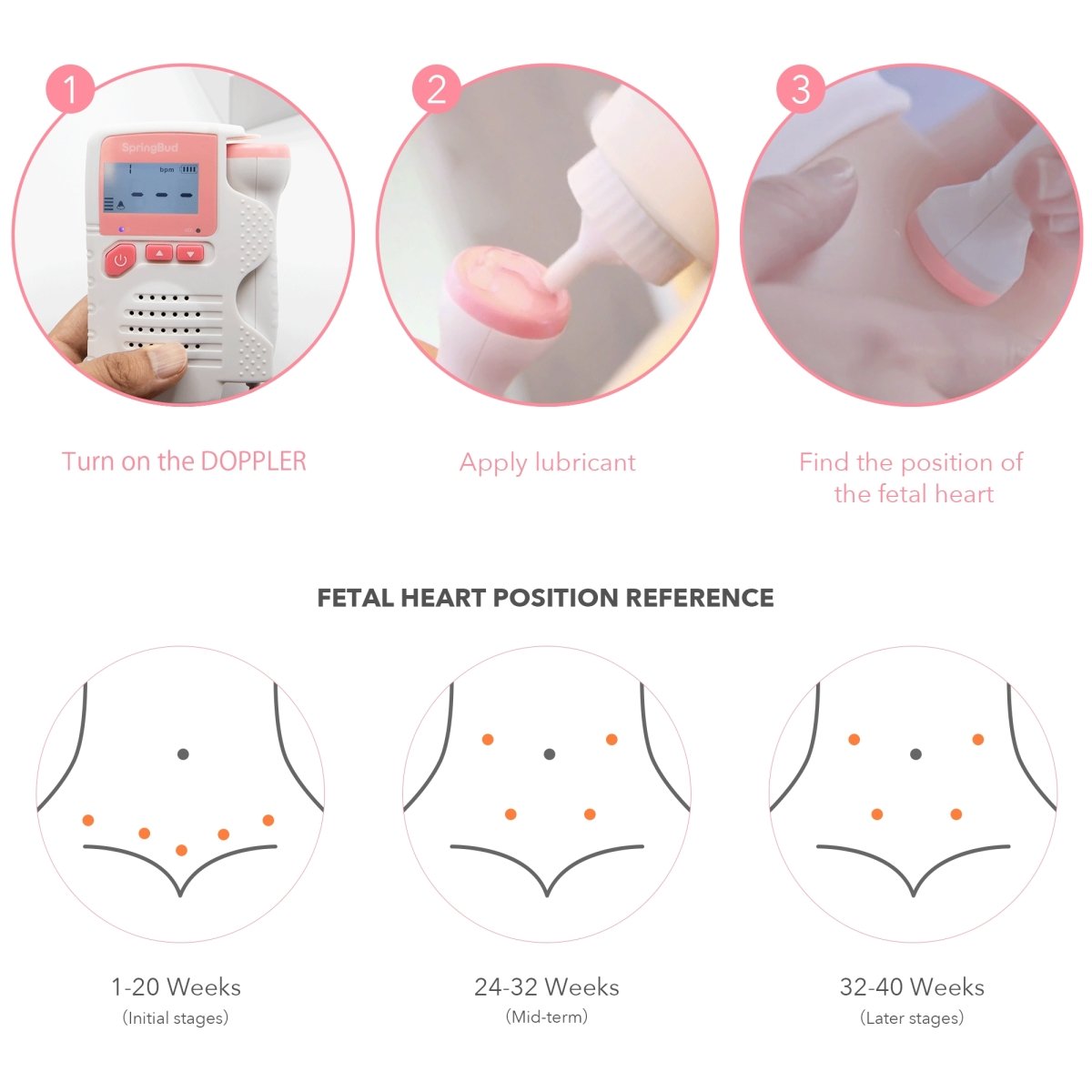 SpringBud FD-200B Fetal Doppler Heart Beat Monitor - SpringBud