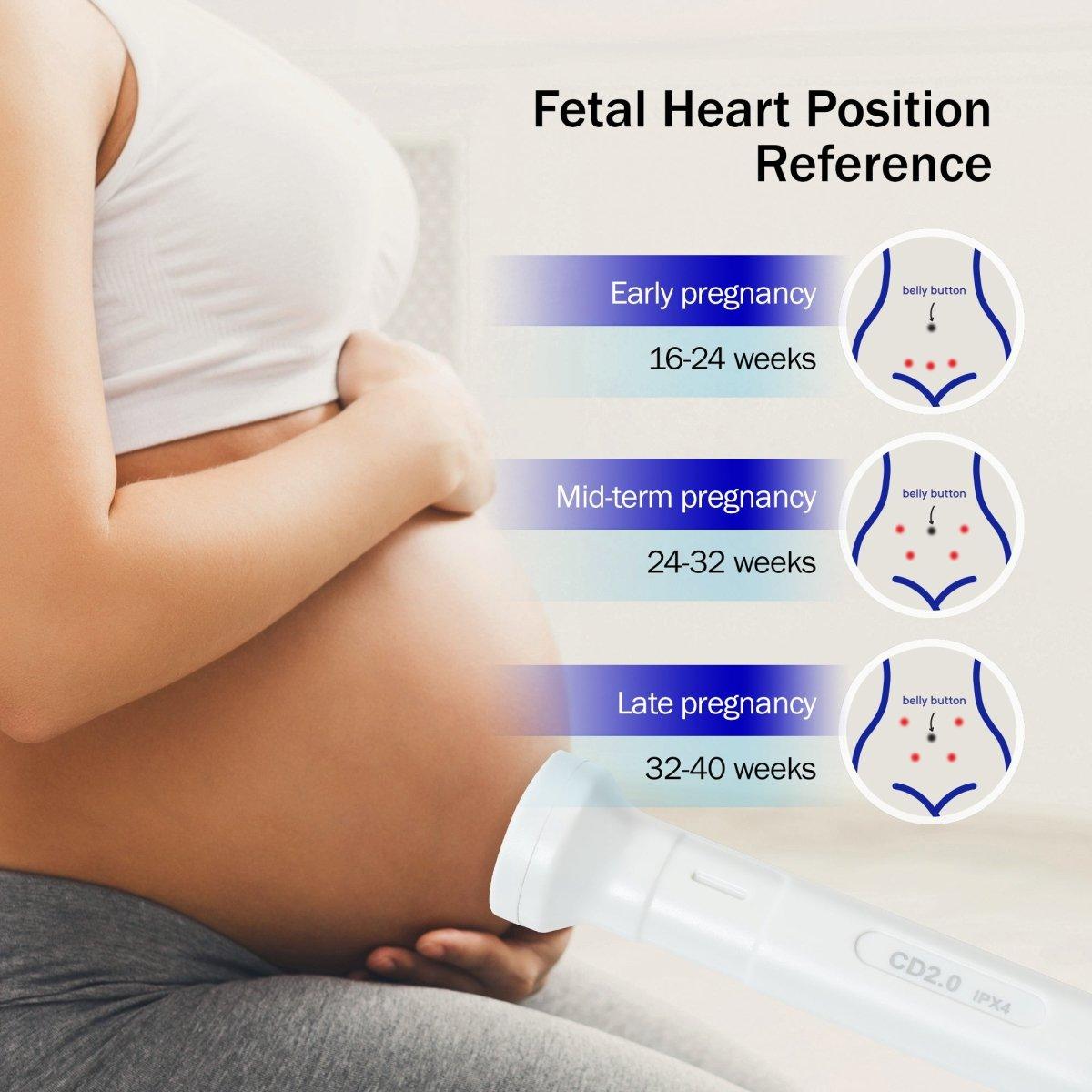 FDA Cleared, Fedex 2-Day Free Shipping, SpringBud FD-500B FDA Fetal Doppler,  Baby Heart rate Monitor